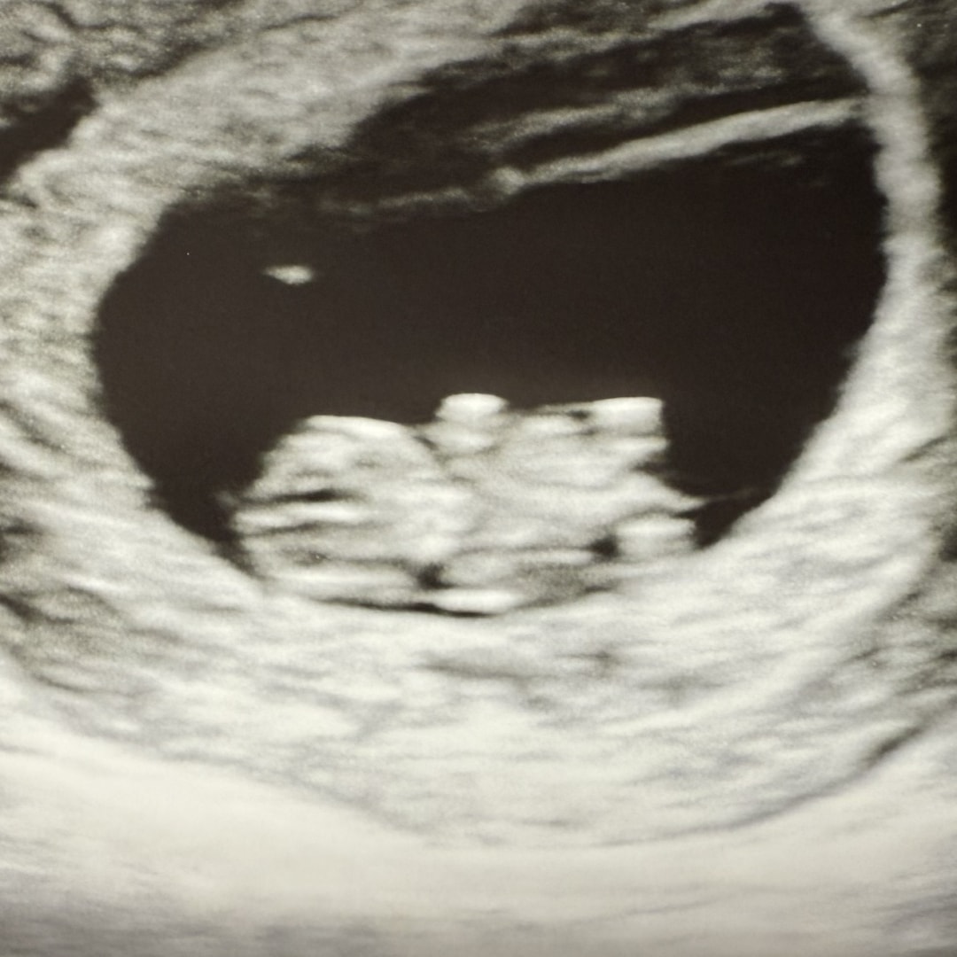 Photo shared by Evelyn for their Babylist baby registry.