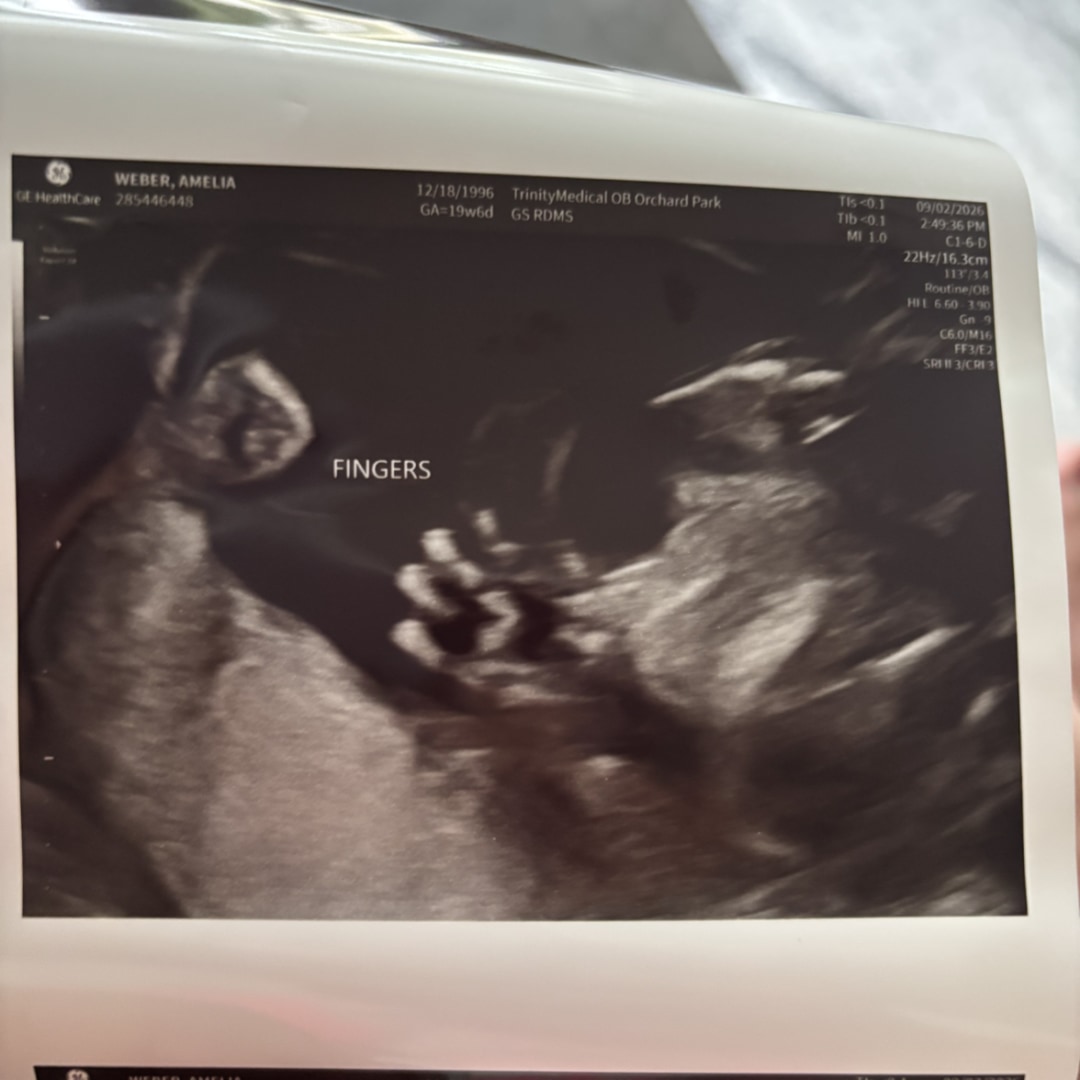 Photo shared by Amelia for their Babylist baby registry.