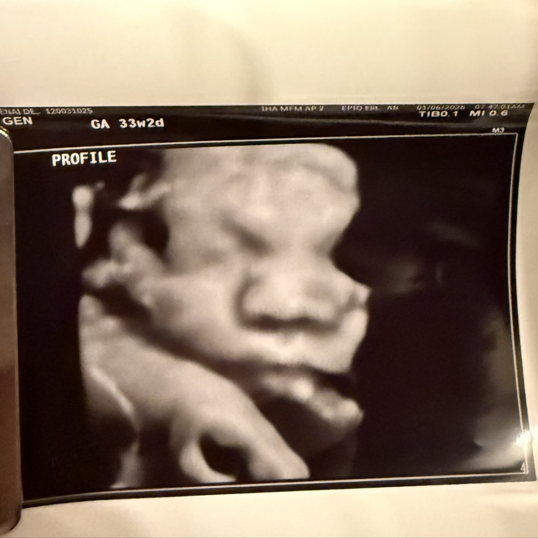 Photo shared by Jenai for their Babylist baby registry.