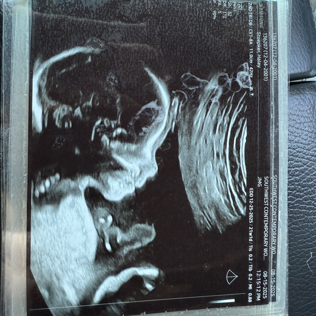 Photo shared by Haley for their Babylist baby registry.