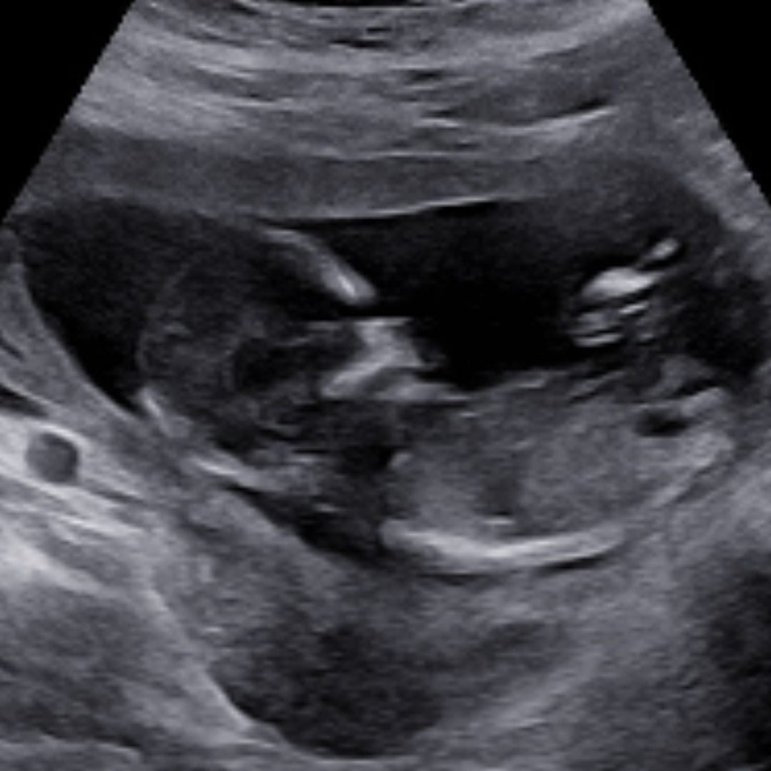 Photo shared by Christy for their Babylist baby registry.