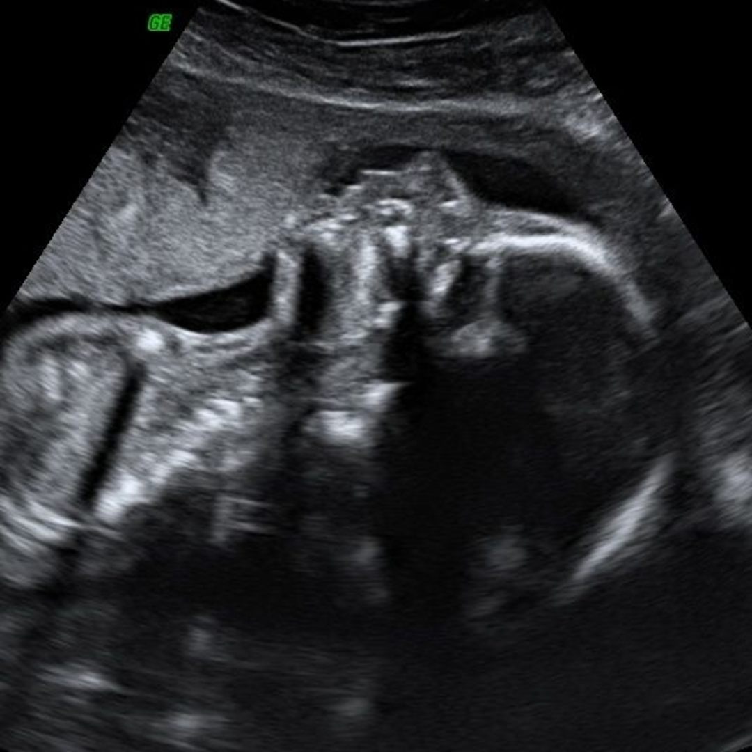 Photo shared by Serenity for their Babylist baby registry.