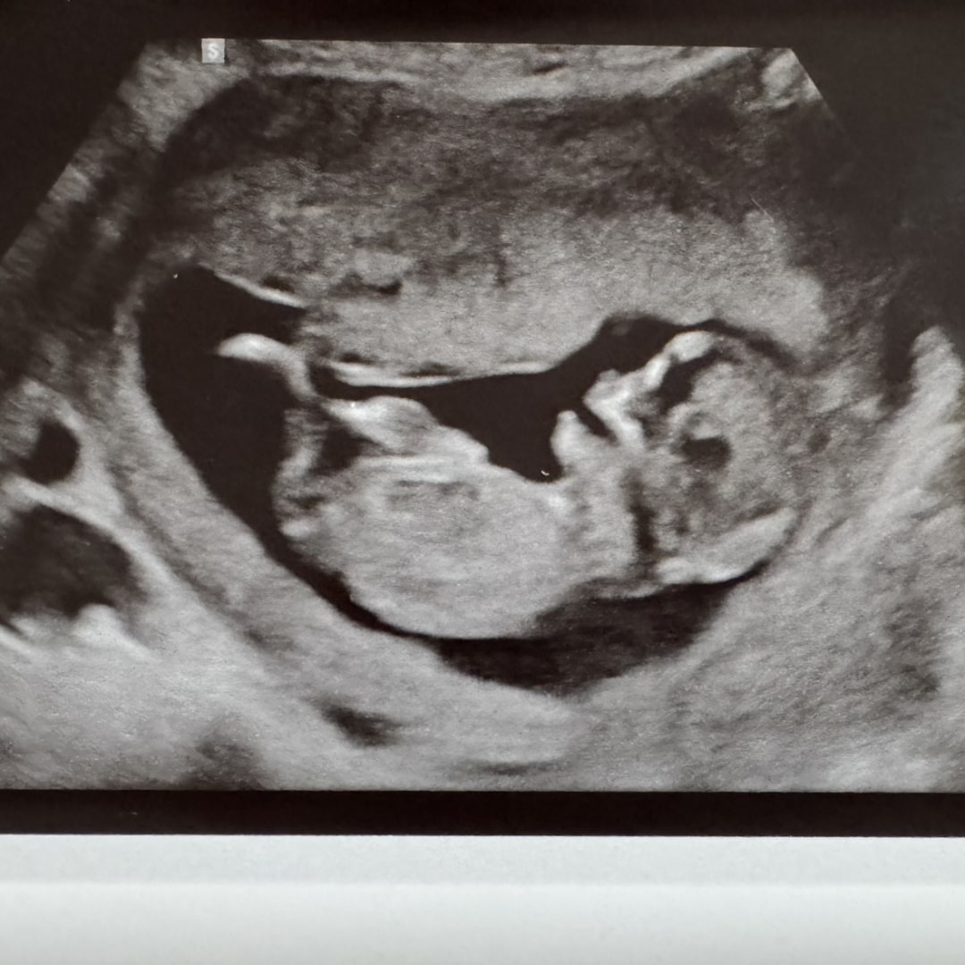 Photo shared by Rachel for their Babylist baby registry.