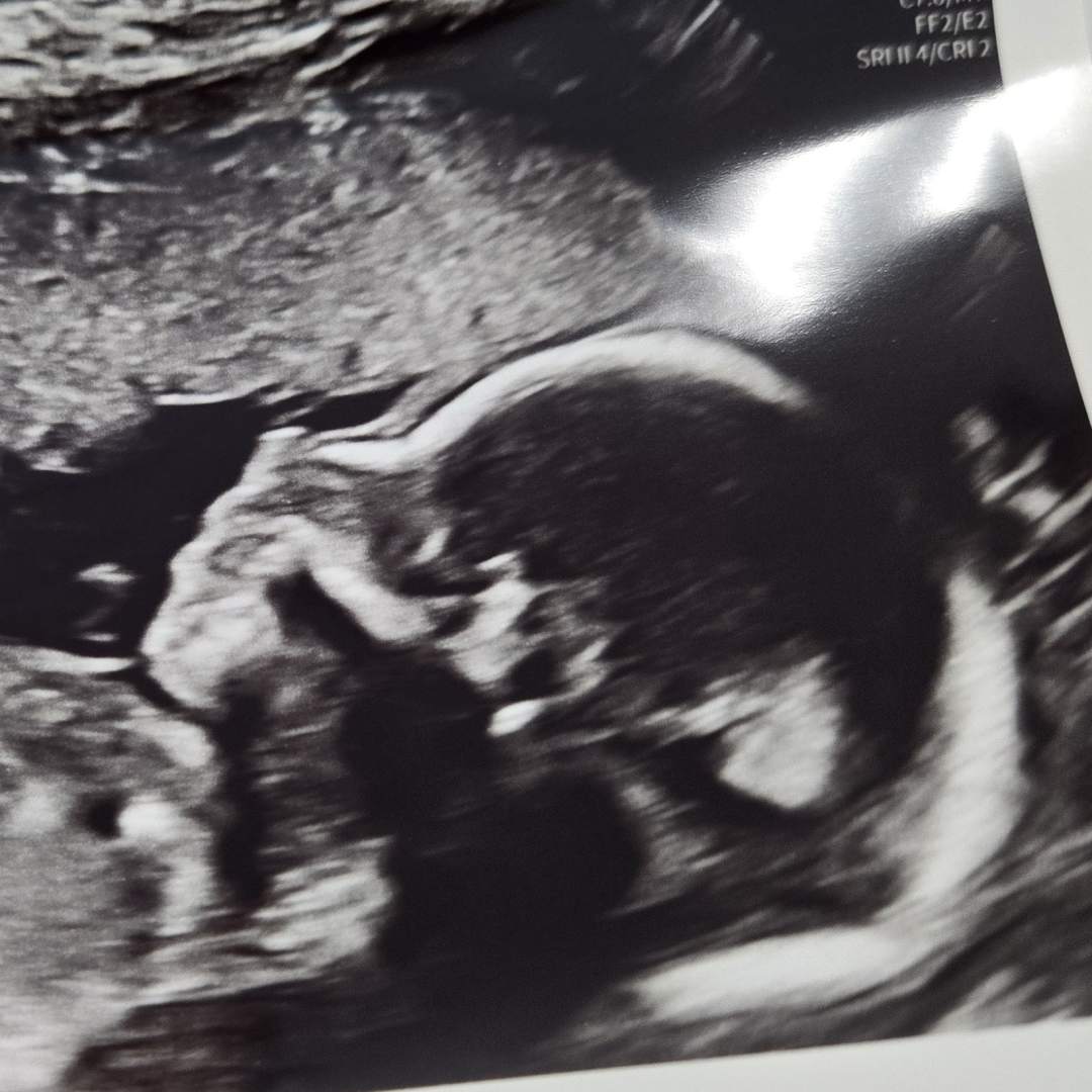 Photo shared by Megan for their Babylist baby registry.