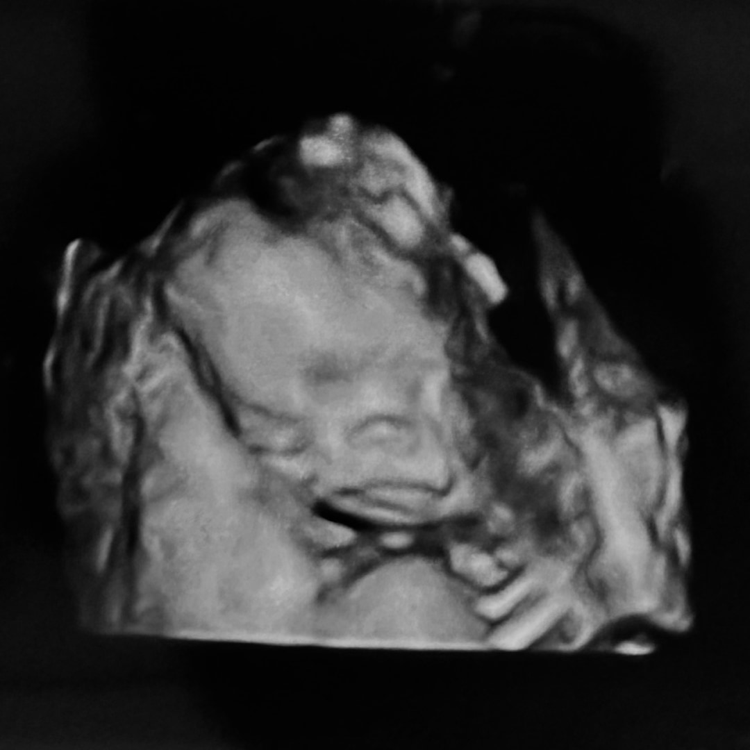 Photo shared by Asmel for their Babylist baby registry.