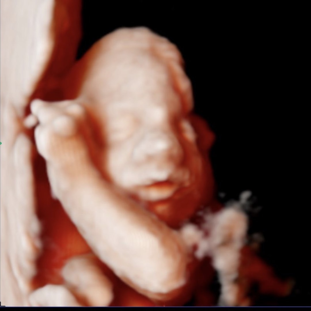 Photo shared by Alize for their Babylist baby registry.