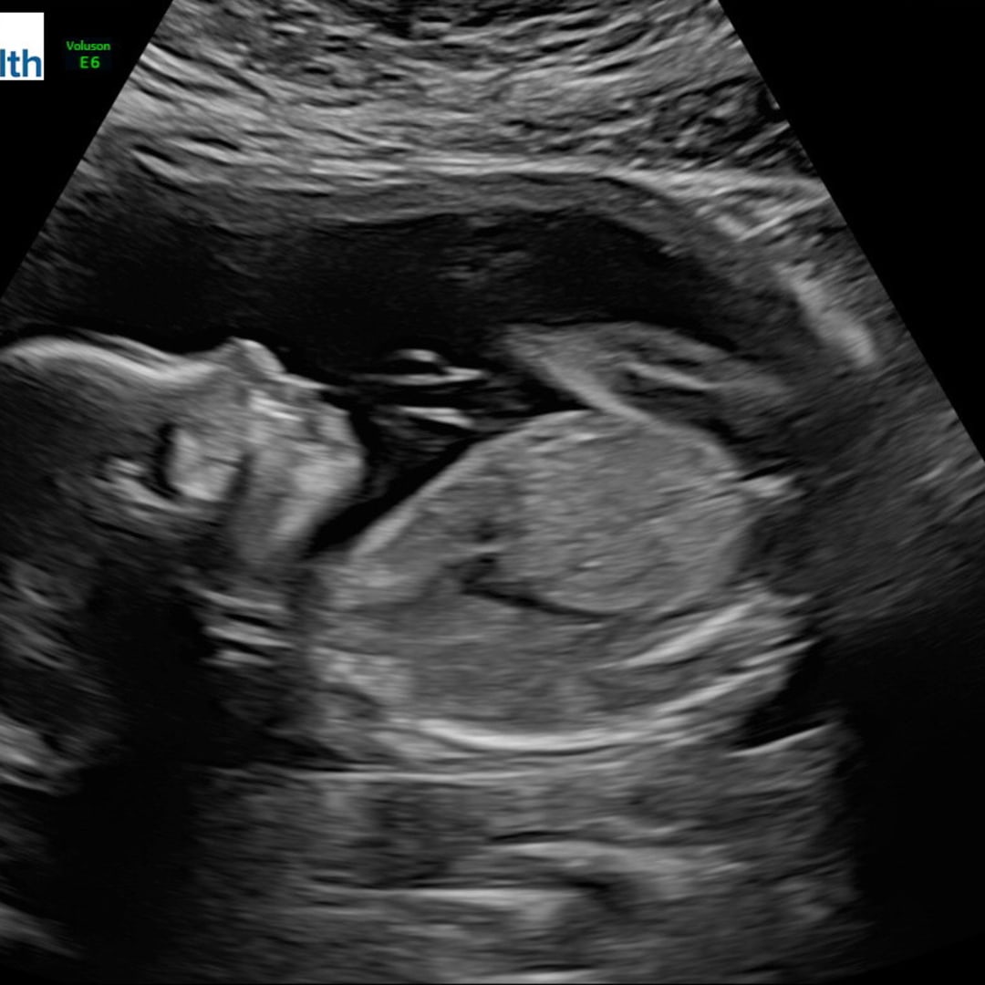 Photo shared by Adriana for their Babylist baby registry.