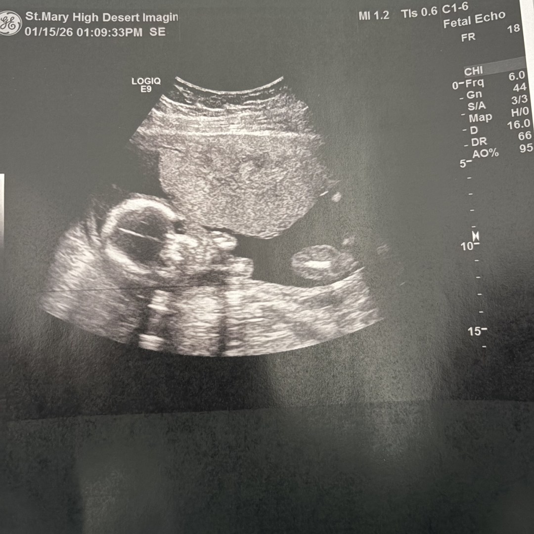 Photo shared by Sharlene for their Babylist baby registry.