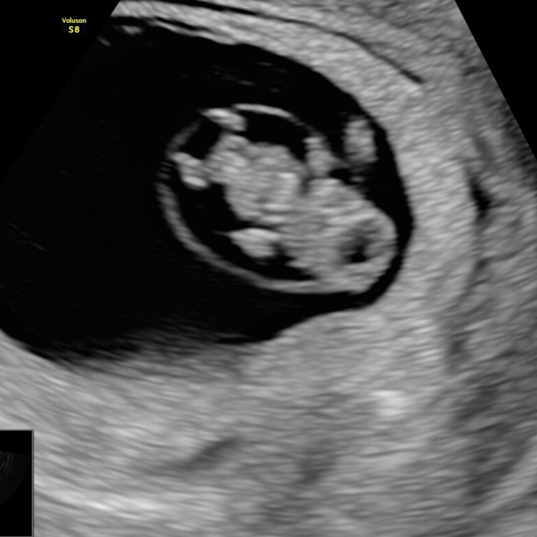 Photo shared by Chelsie for their Babylist baby registry.