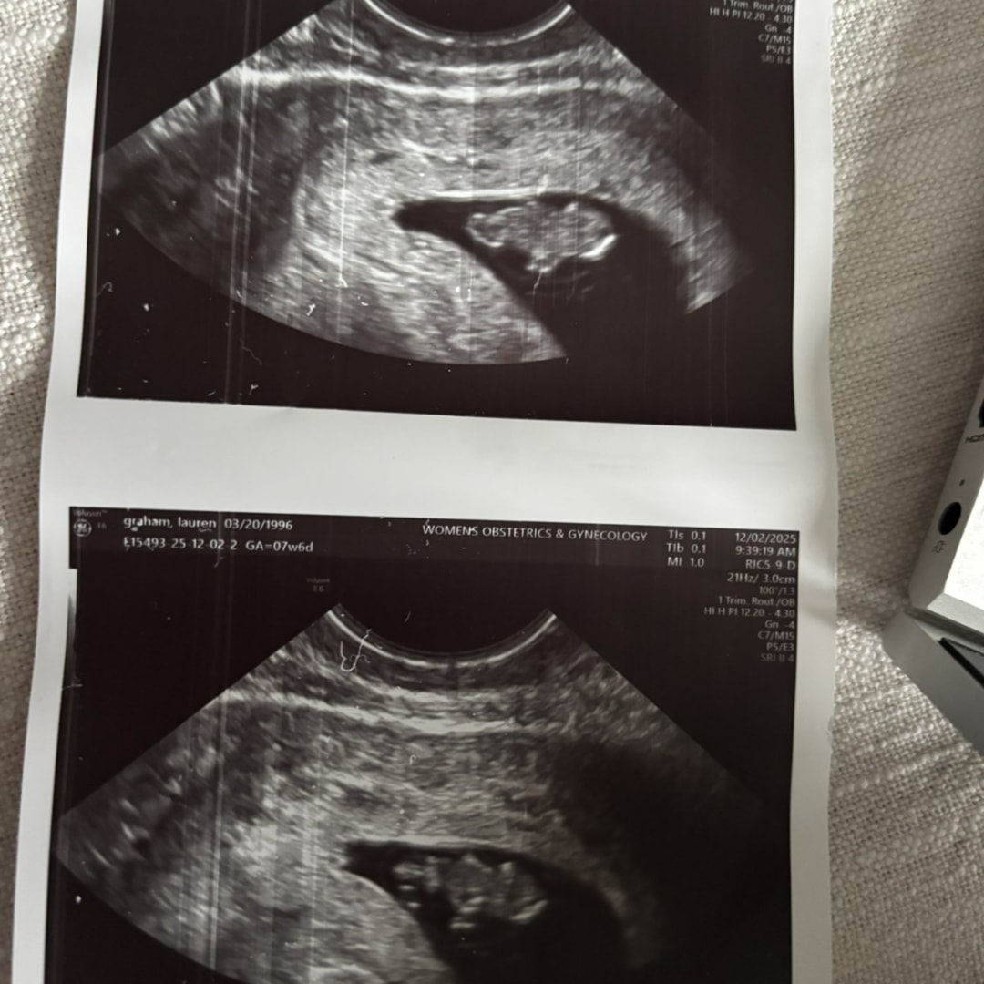 Photo shared by Lauren for their Babylist baby registry.