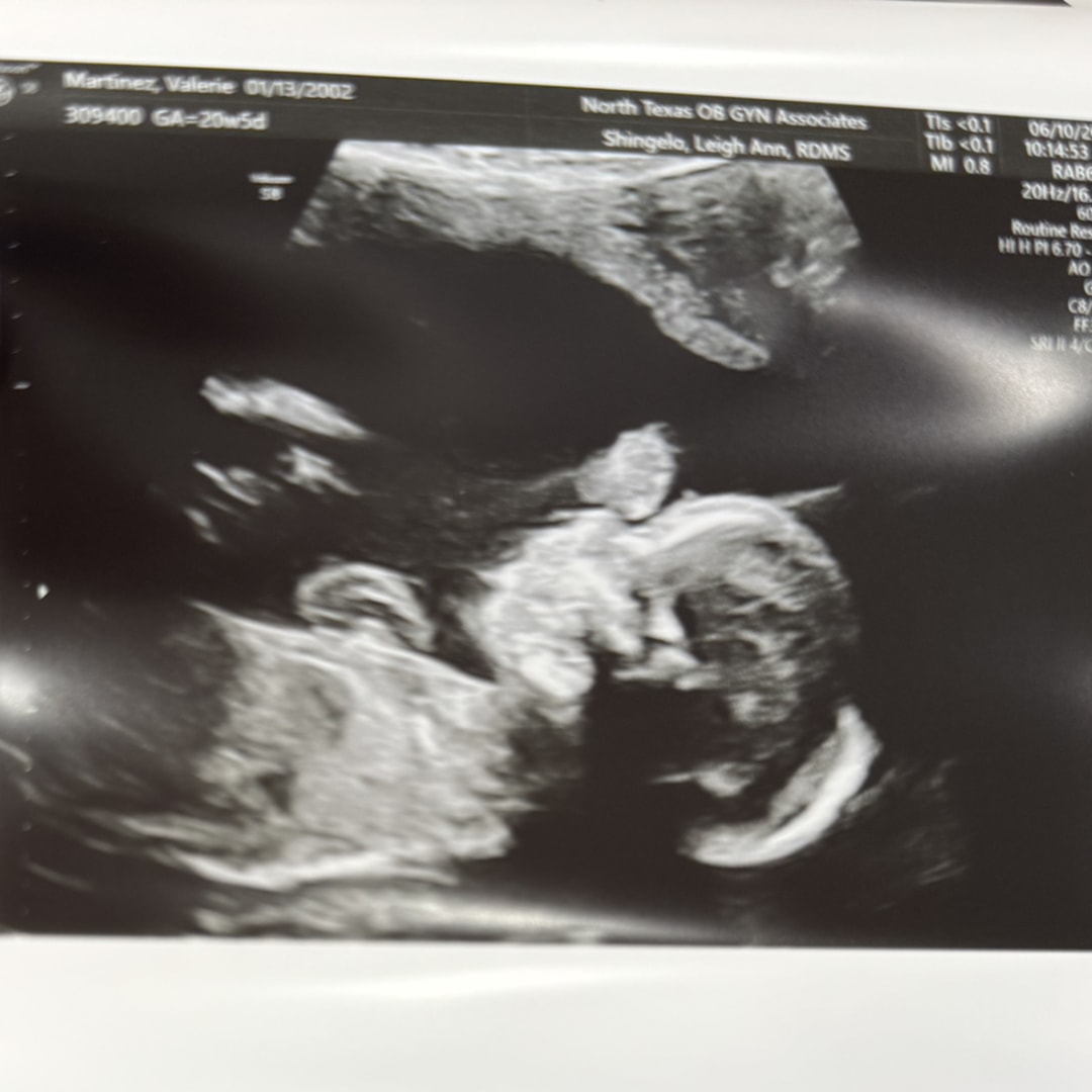 Photo shared by Valerie for their Babylist baby registry.