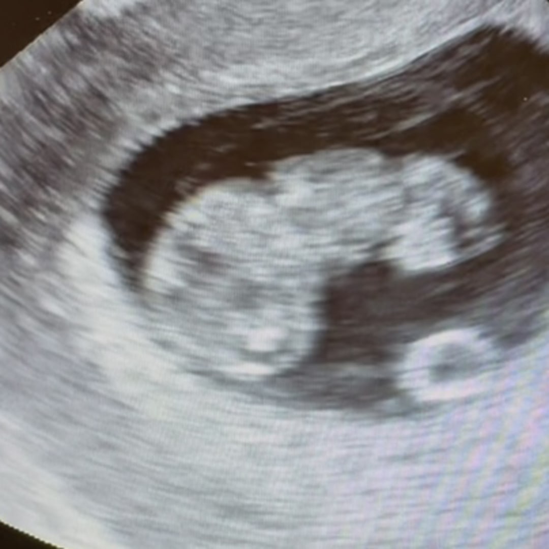 Photo shared by Houston and Alex for their Babylist baby registry.