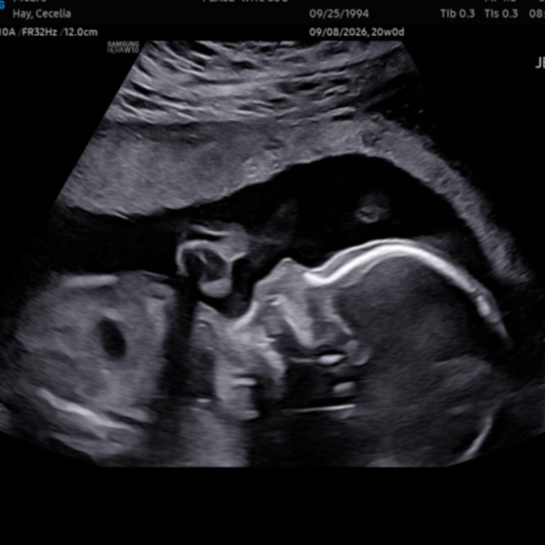 Photo shared by Cecelia for their Babylist baby registry.
