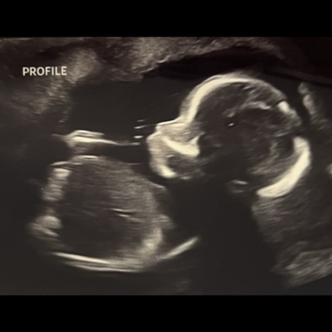 Photo shared by Allysia for their Babylist baby registry.
