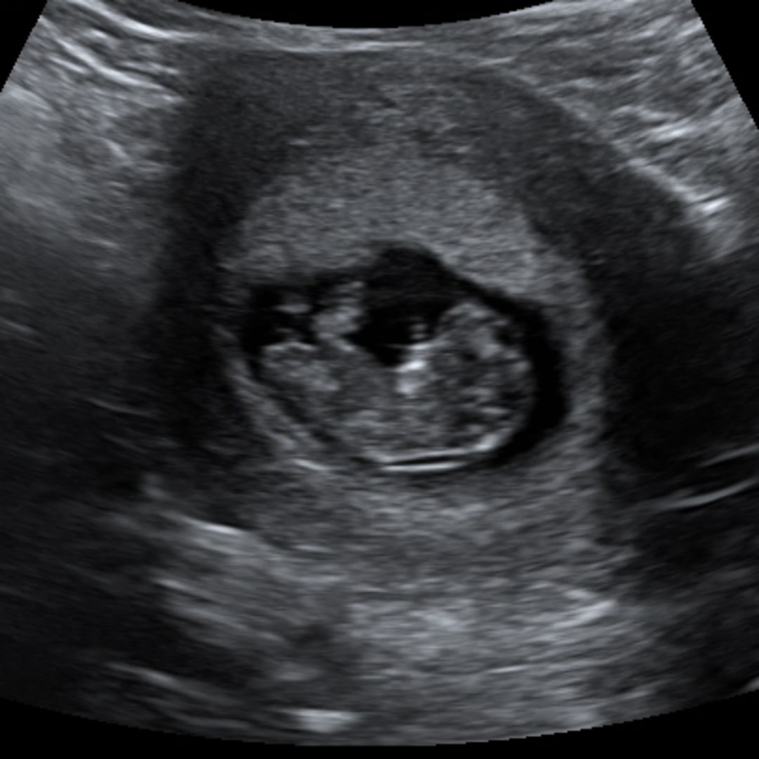 Photo shared by Carly for their Babylist baby registry.