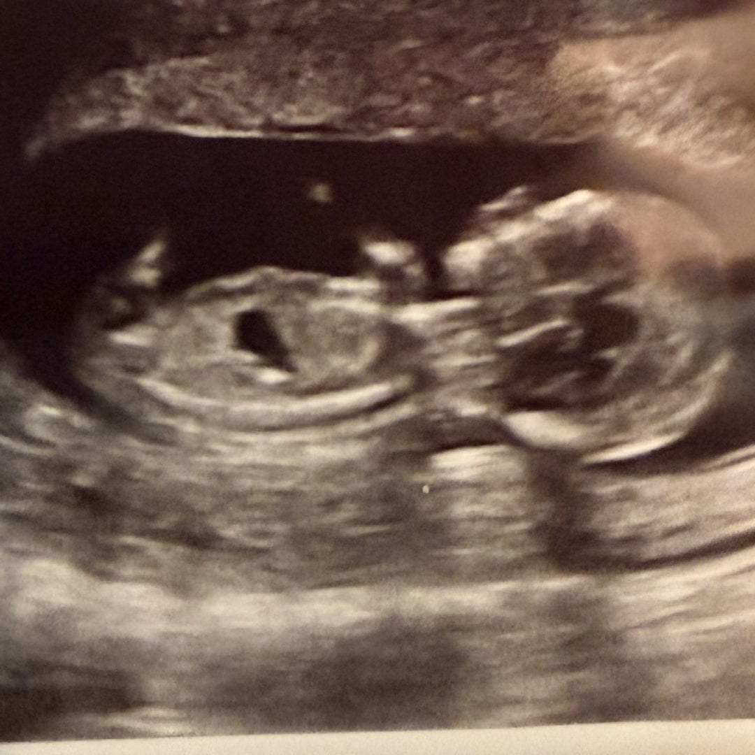 Photo shared by Amie for their Babylist baby registry.