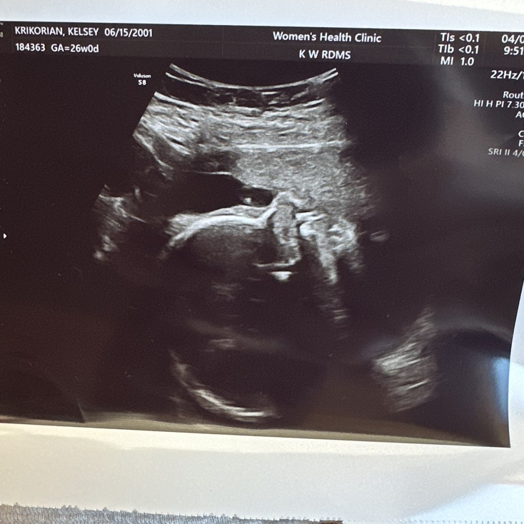 Photo shared by Kelsey for their Babylist baby registry.