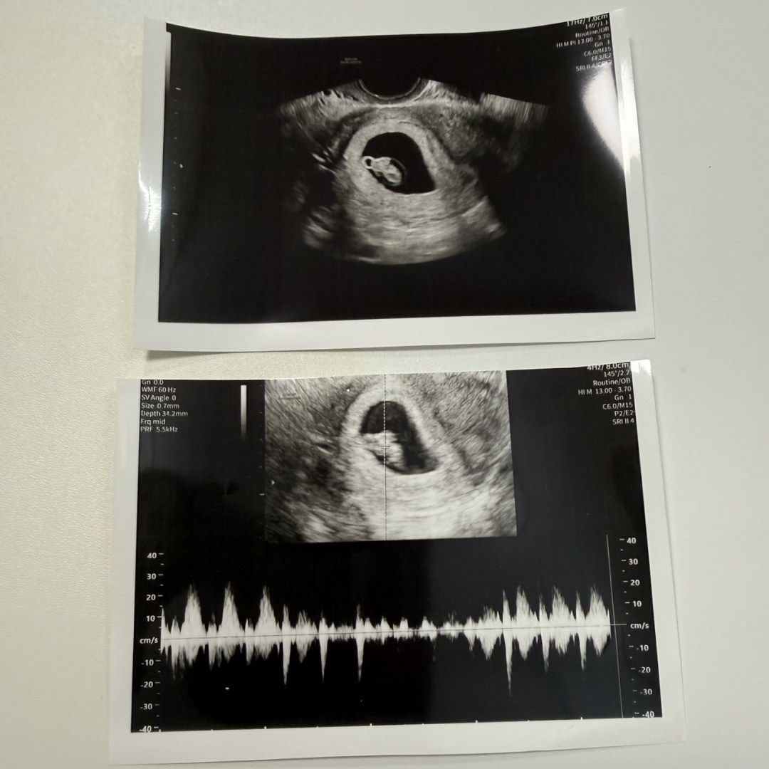 Photo shared by Lindsay for their Babylist baby registry.