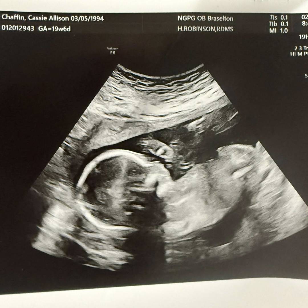 Photo shared by Cassie for their Babylist baby registry.