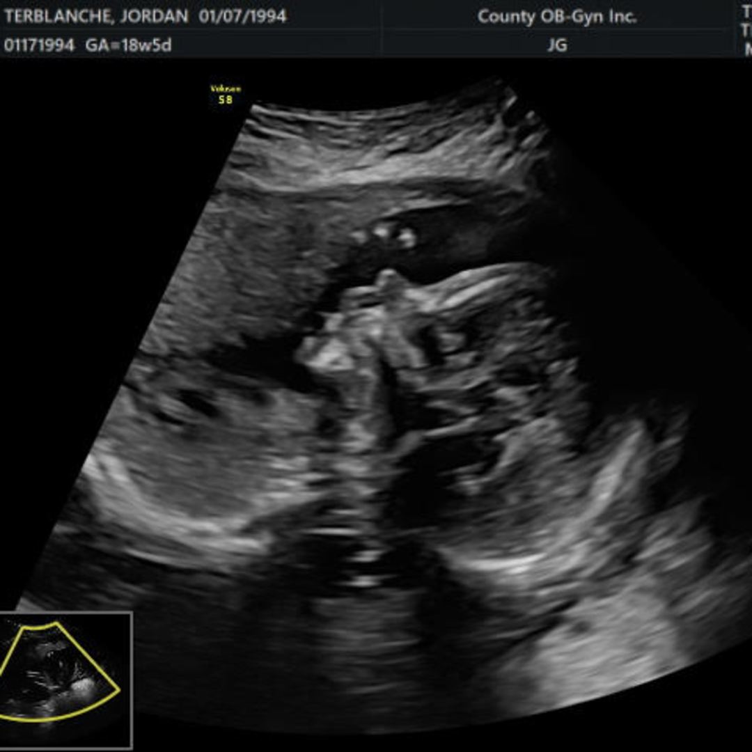 Photo shared by Jordan for their Babylist baby registry.