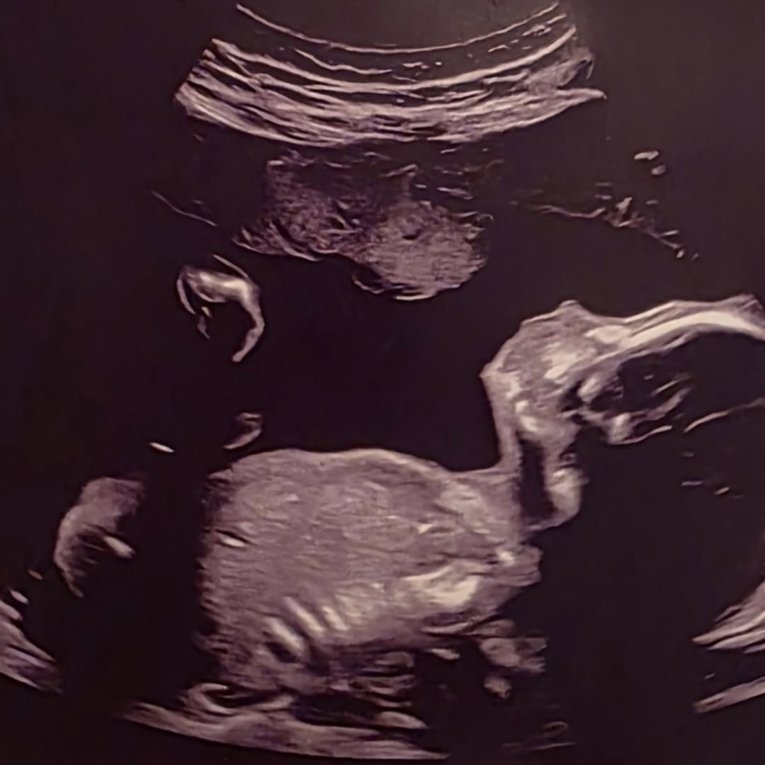 Photo shared by Monique for their Babylist baby registry.