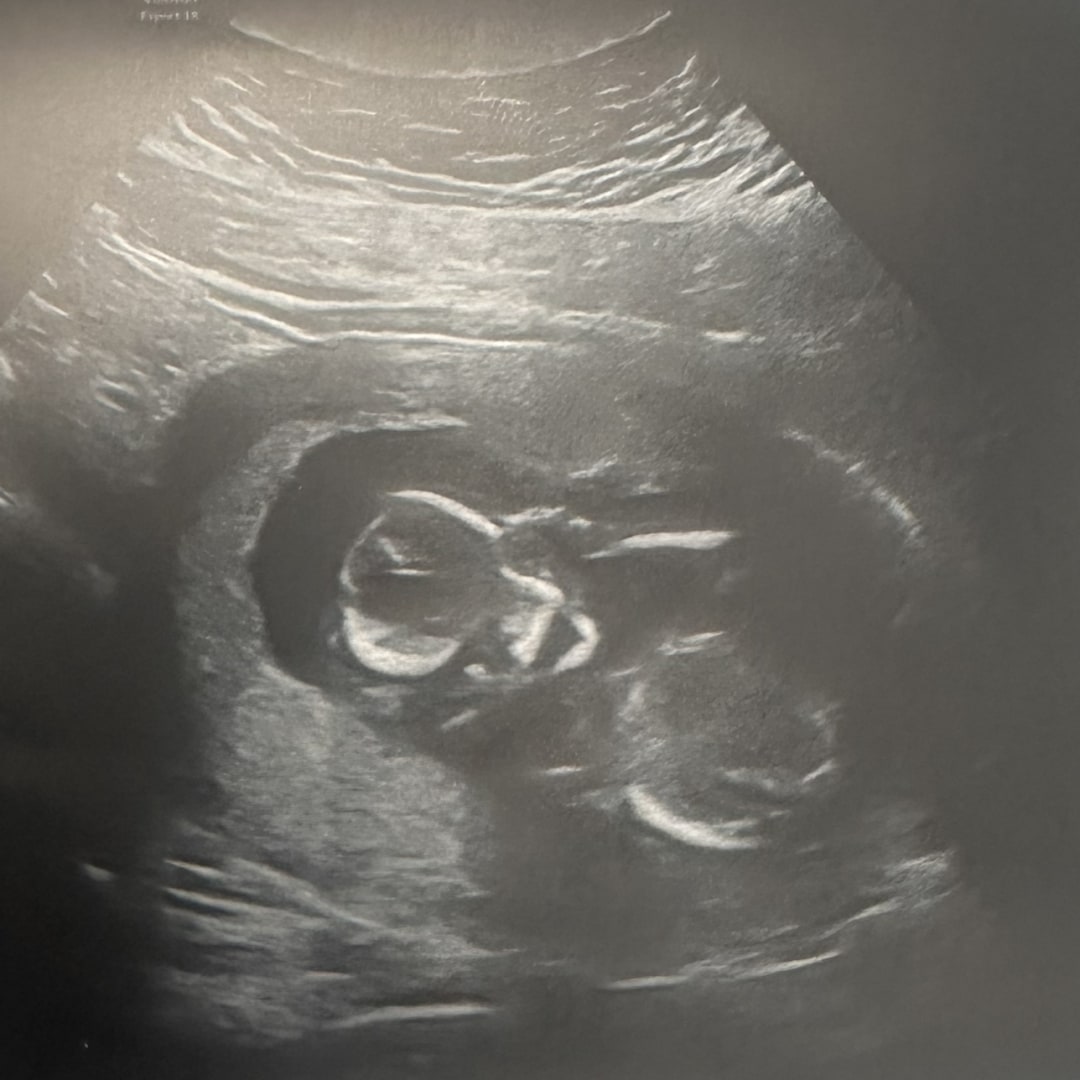 Photo shared by Dakota for their Babylist baby registry.