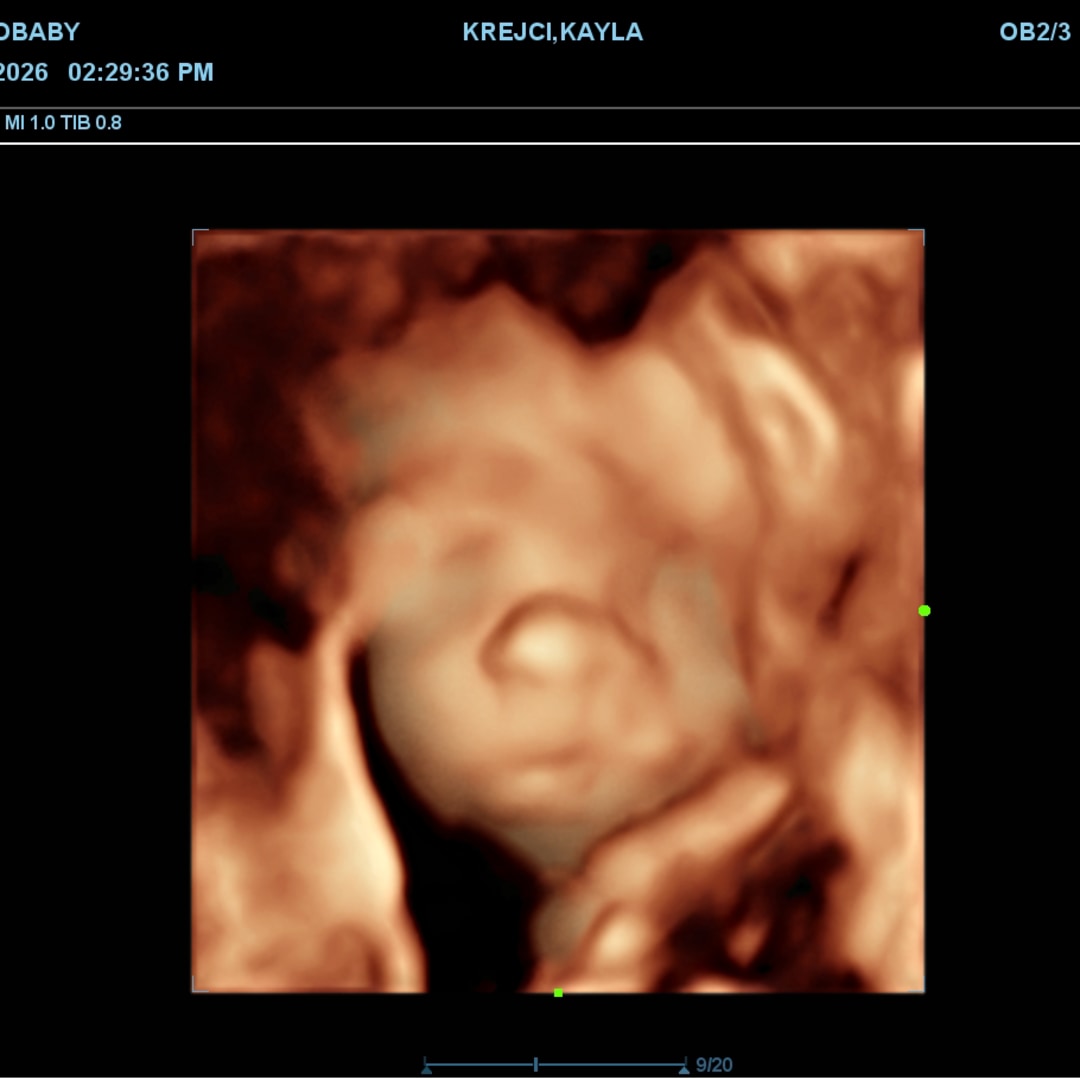 Photo shared by Kayla for their Babylist baby registry.