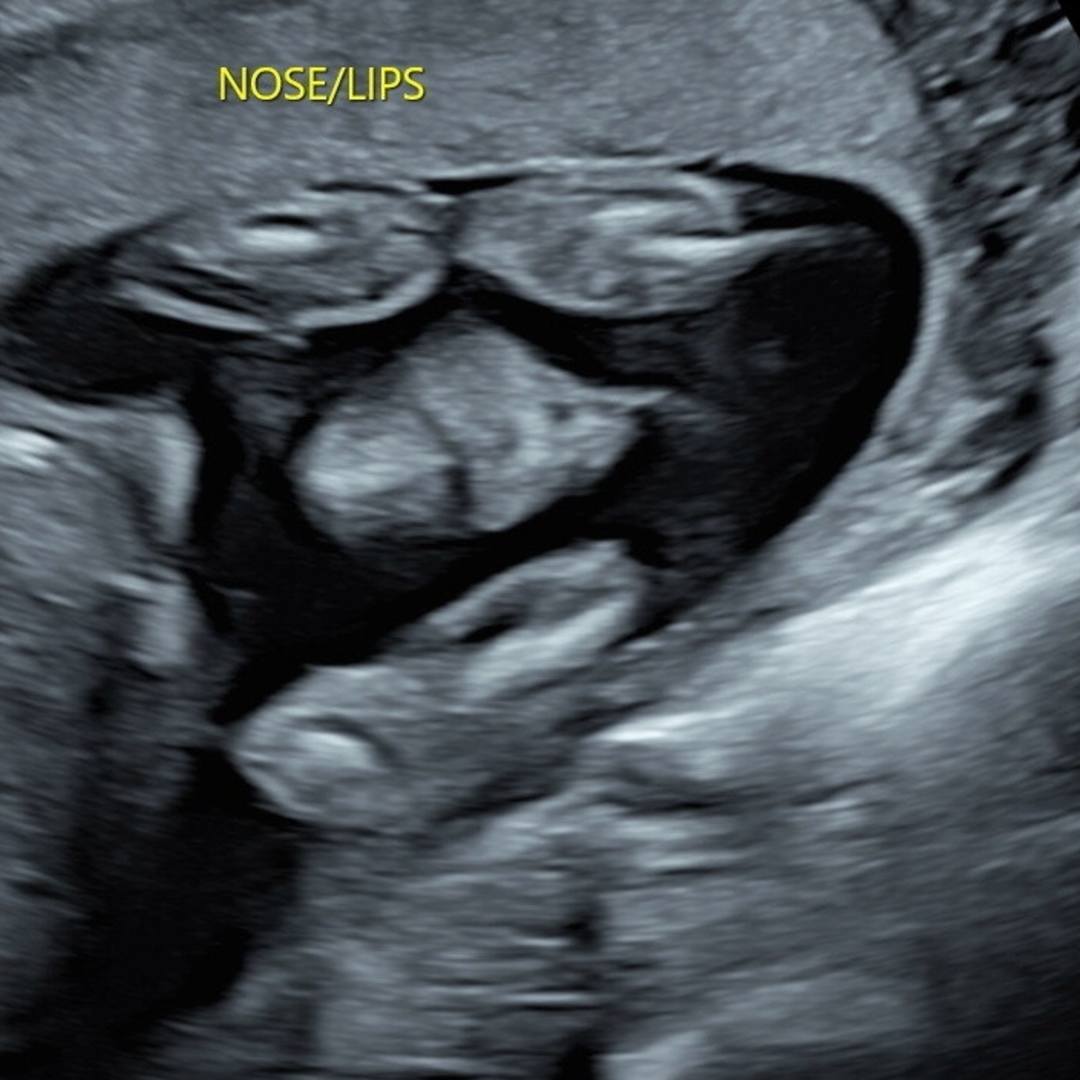 Photo shared by Shailee And Ricky for their Babylist baby registry.