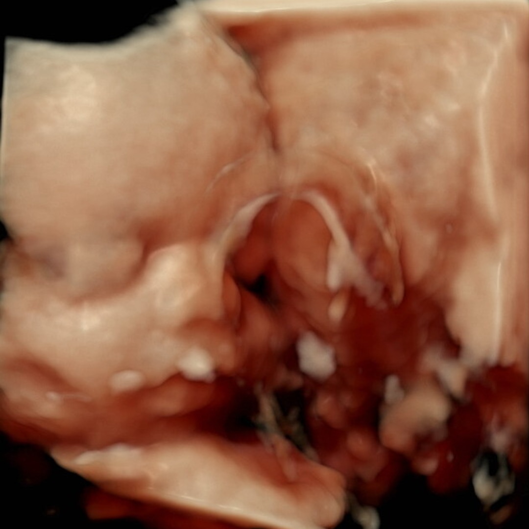 Photo shared by Courtney for their Babylist baby registry.