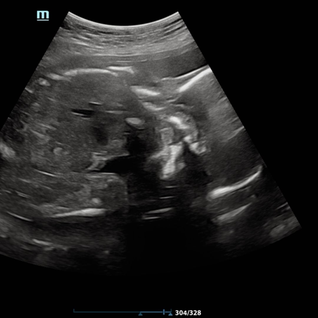 Photo shared by Meagan for their Babylist baby registry.