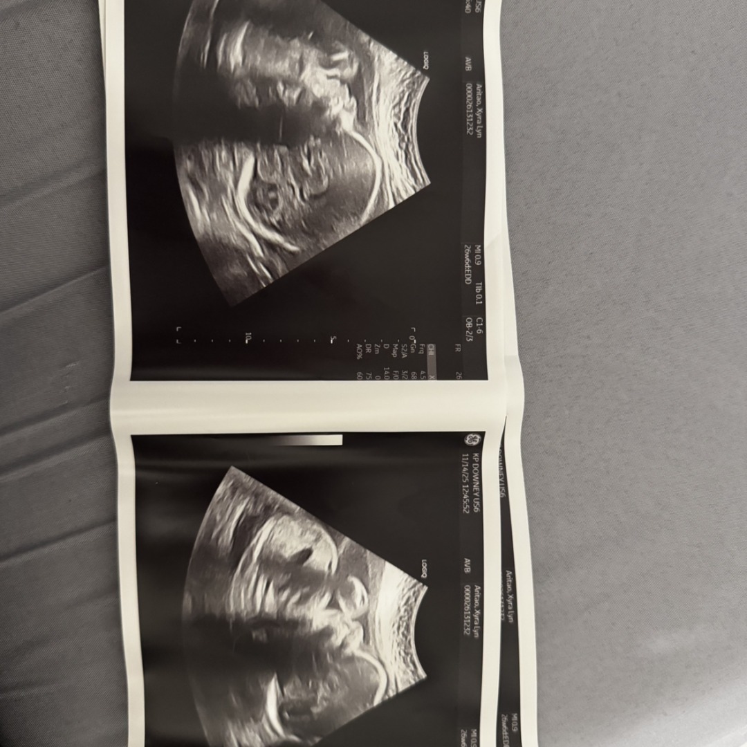 Photo shared by Xyra Lyn for their Babylist baby registry.