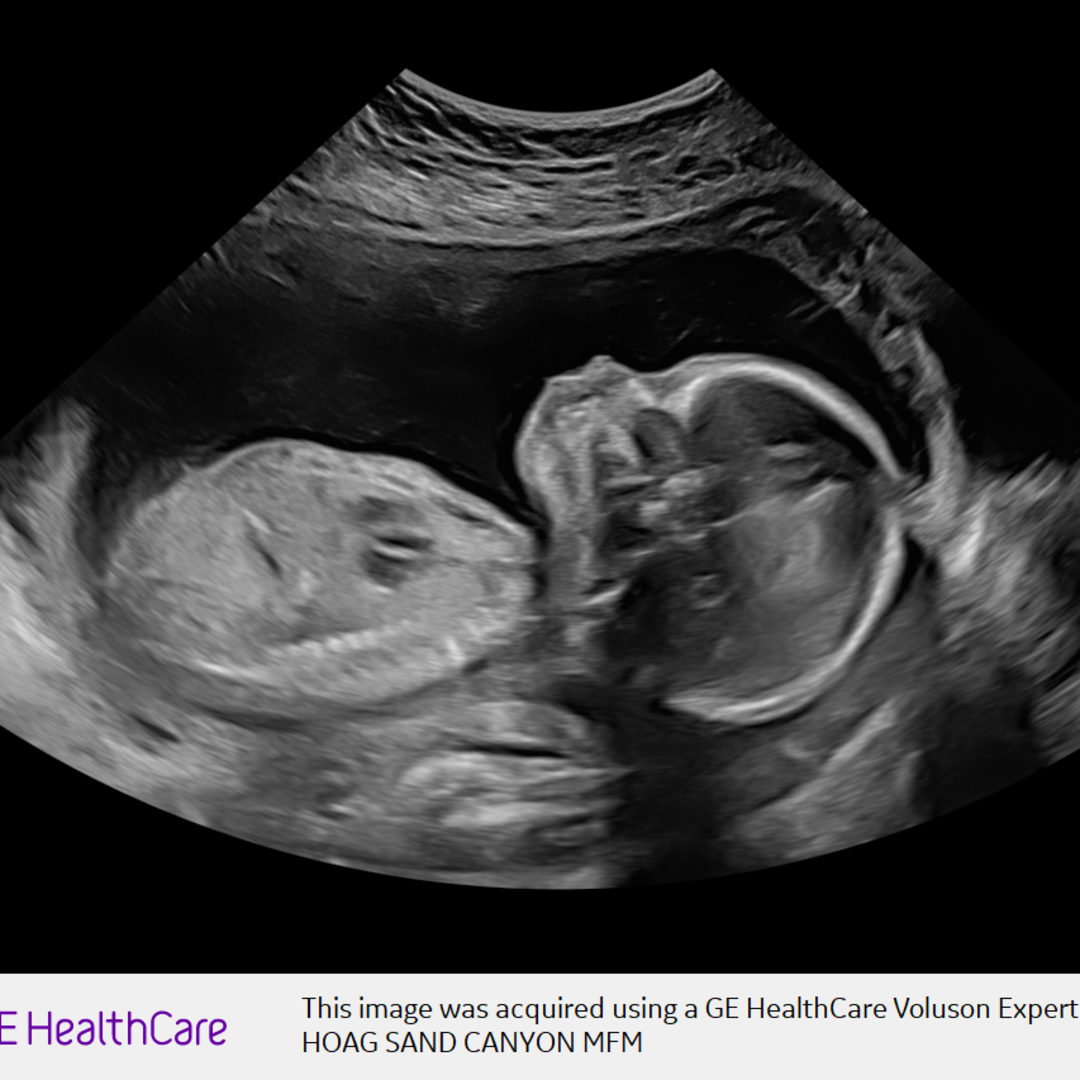 Photo shared by Jessica for their Babylist baby registry.