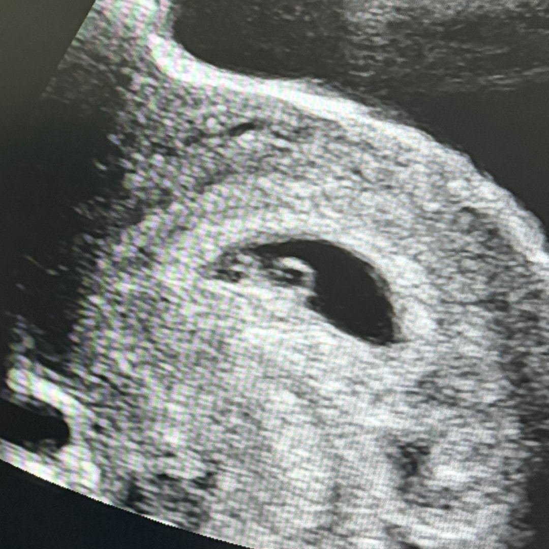 Photo shared by Emma for their Babylist baby registry.