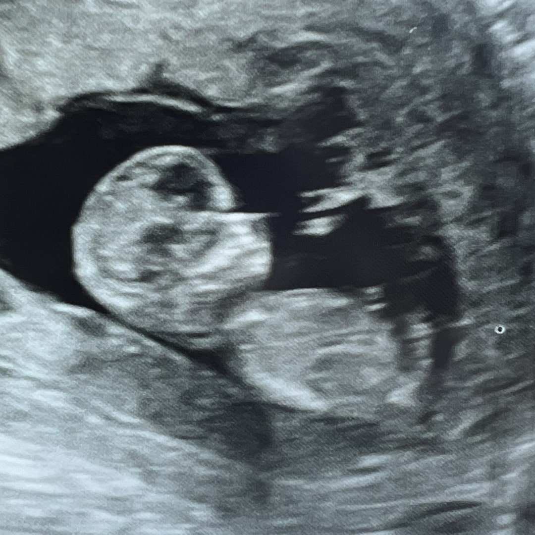 Photo shared by Tricia for their Babylist baby registry.