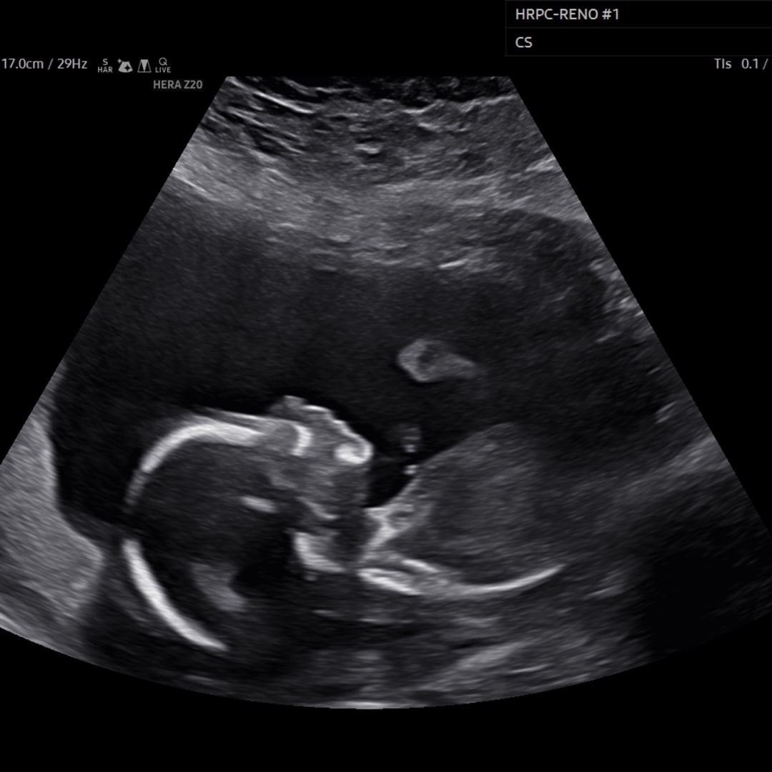 Photo shared by Rebecca for their Babylist baby registry.