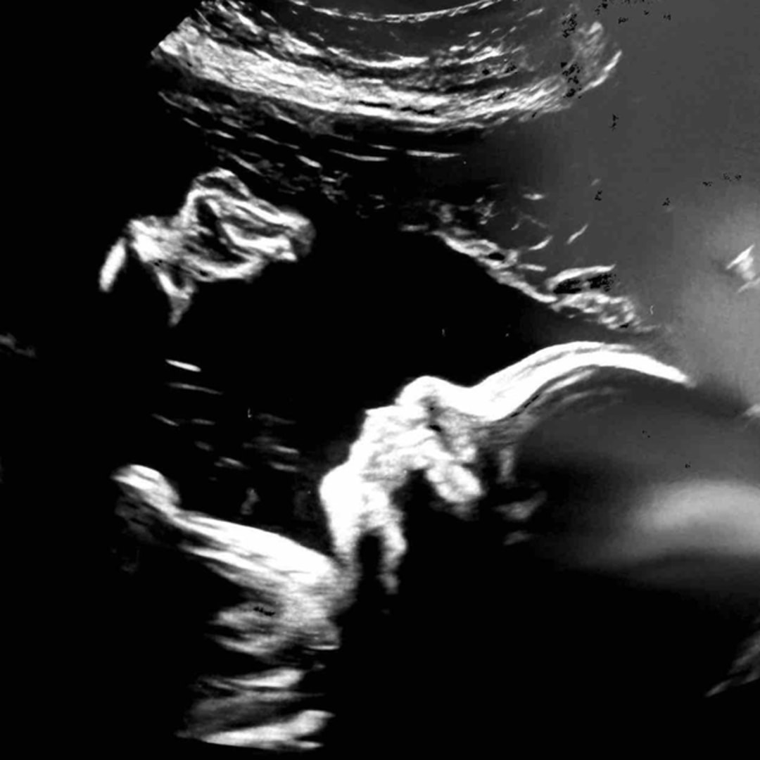 Photo shared by Melany for their Babylist baby registry.