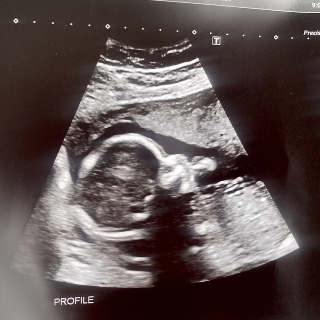 Photo shared by Jenny for their Babylist baby registry.