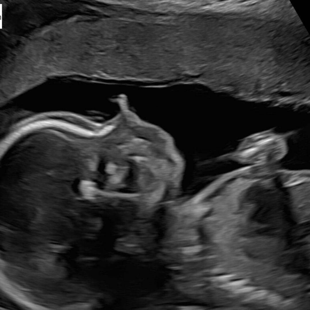 Photo shared by Alexis for their Babylist baby registry.