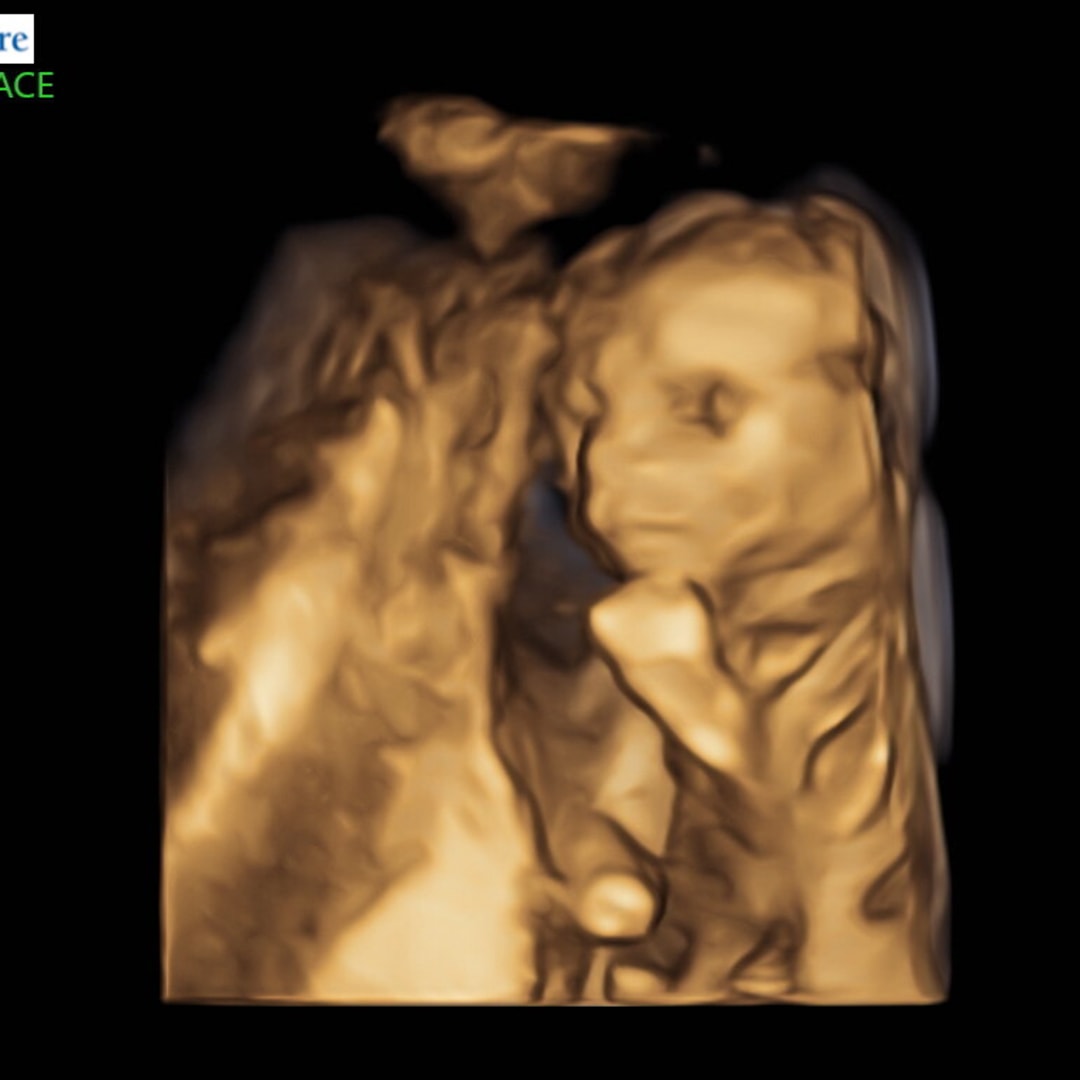 Photo shared by Erin for their Babylist baby registry.