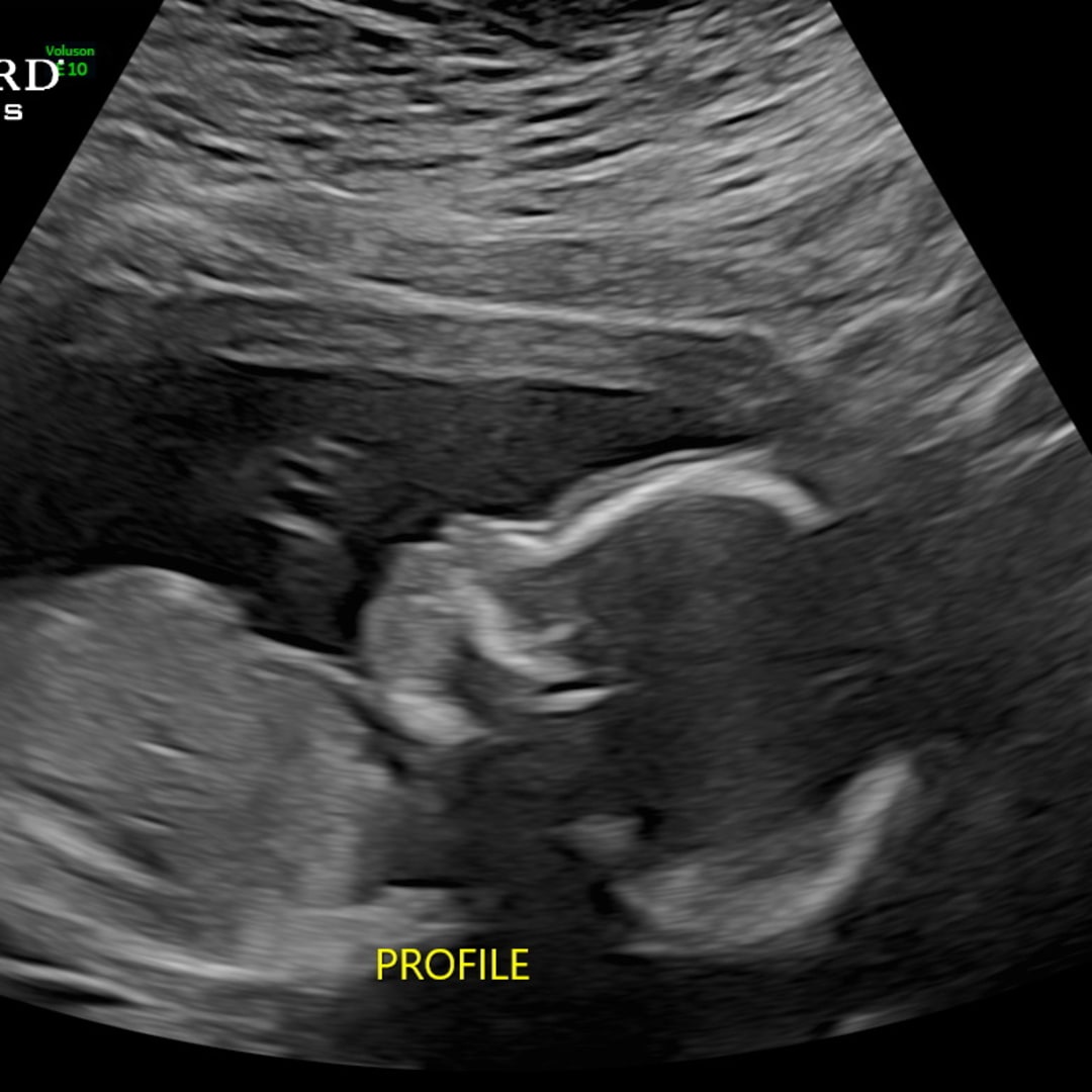 Photo shared by Emily for their Babylist baby registry.