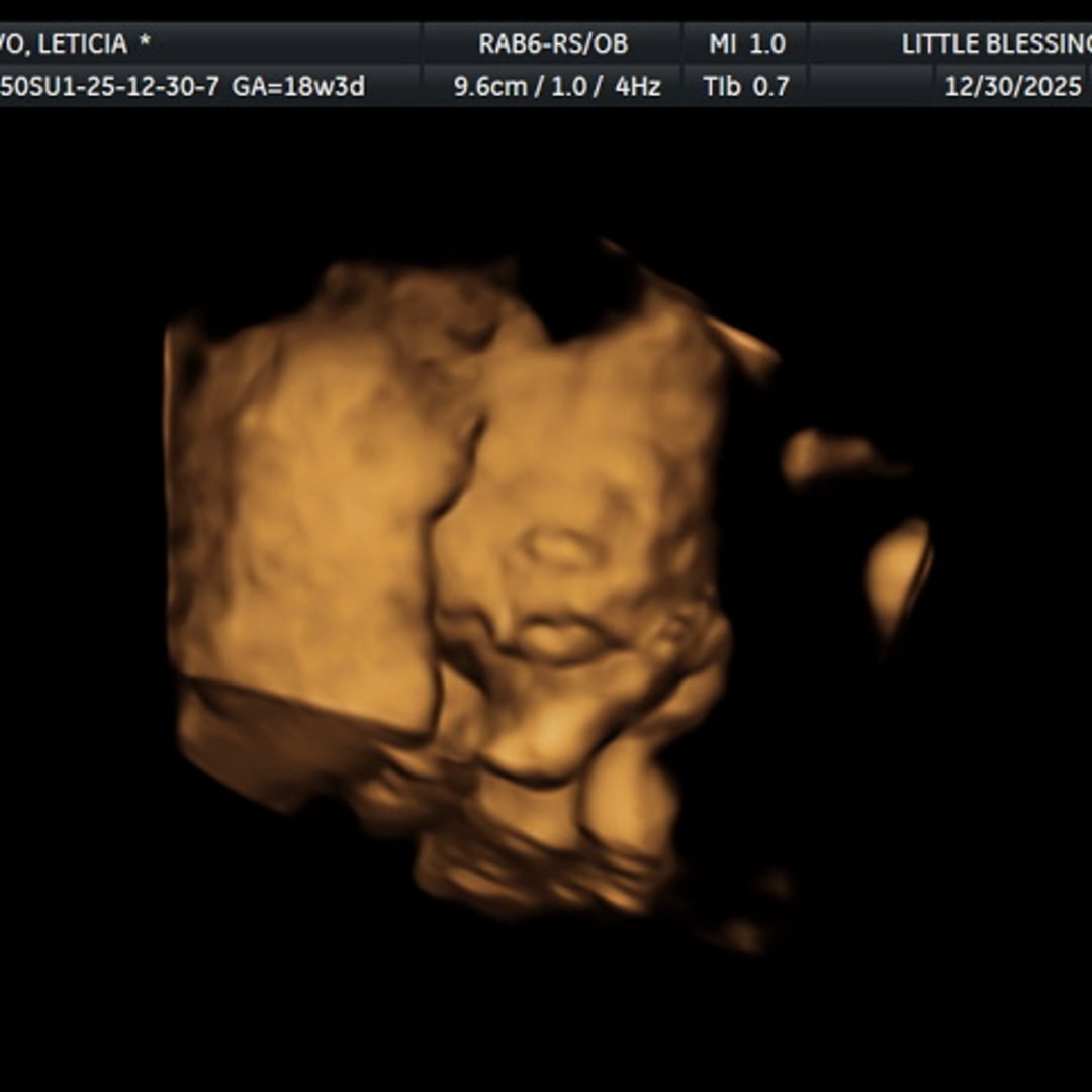 Photo shared by Leticia for their Babylist baby registry.