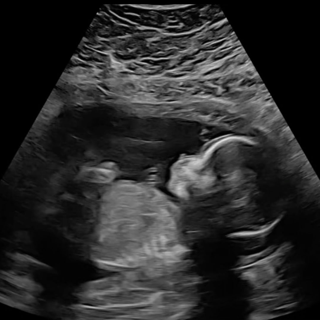 Photo shared by Hannah for their Babylist baby registry.