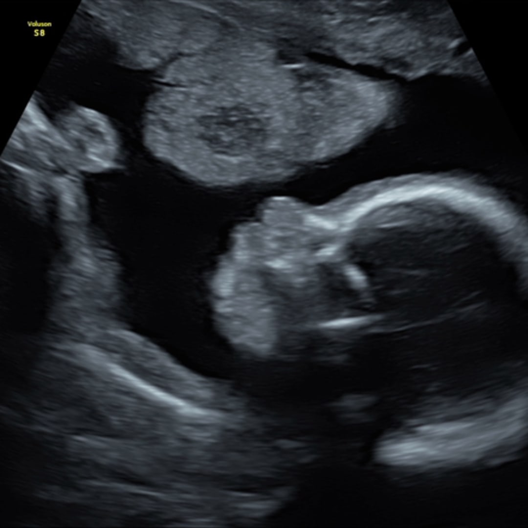 Photo shared by Amber for their Babylist baby registry.