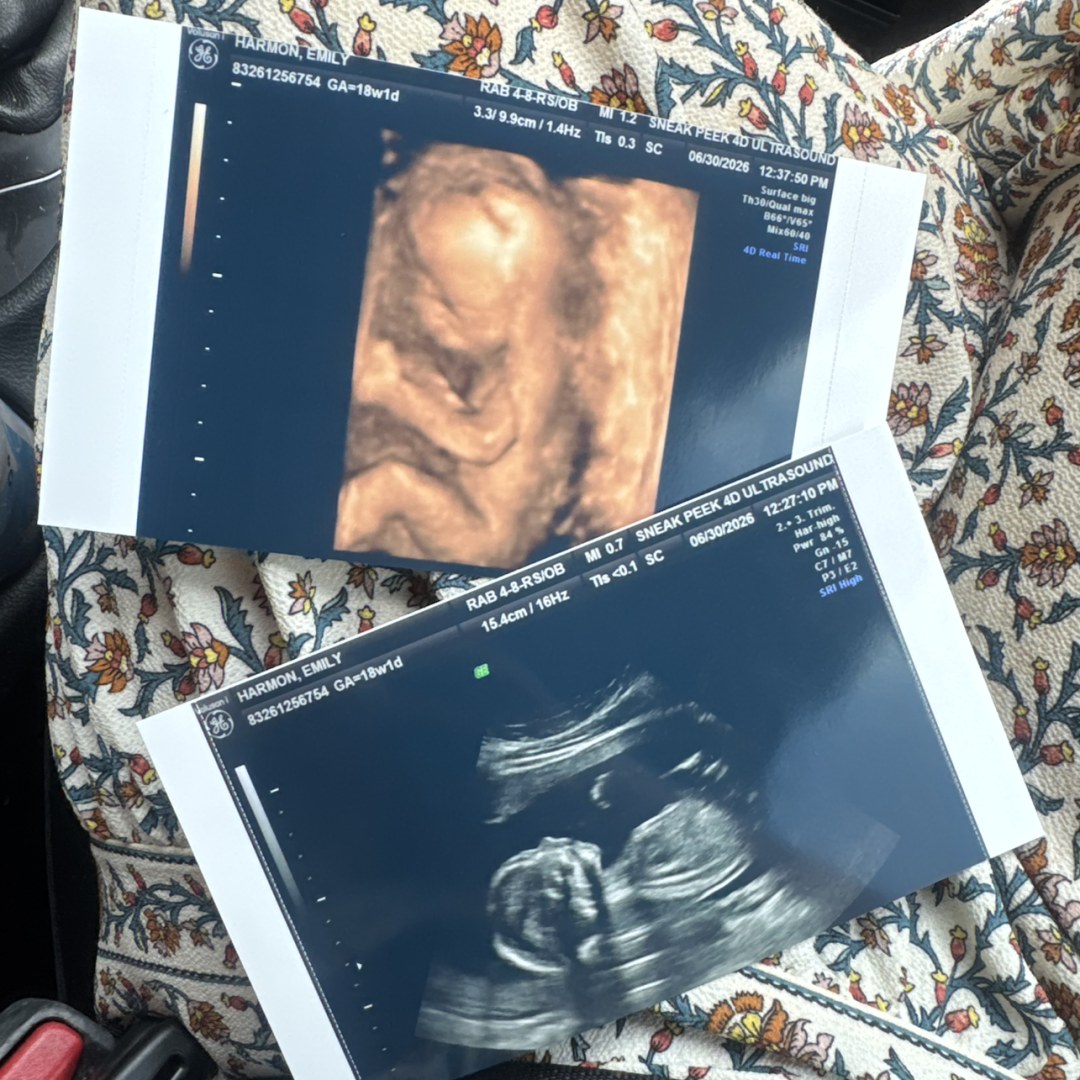 Photo shared by Emily for their Babylist baby registry.