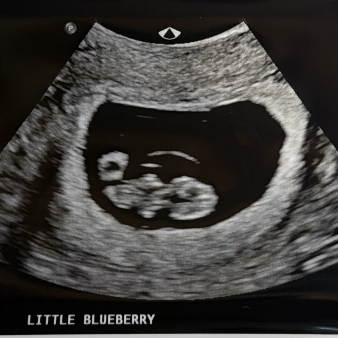 Photo shared by Ryan for their Babylist baby registry.