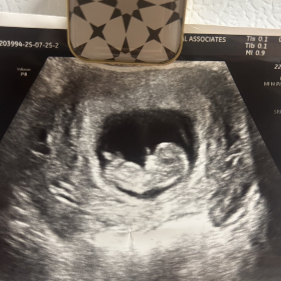 Photo shared by Abigail for their Babylist baby registry.