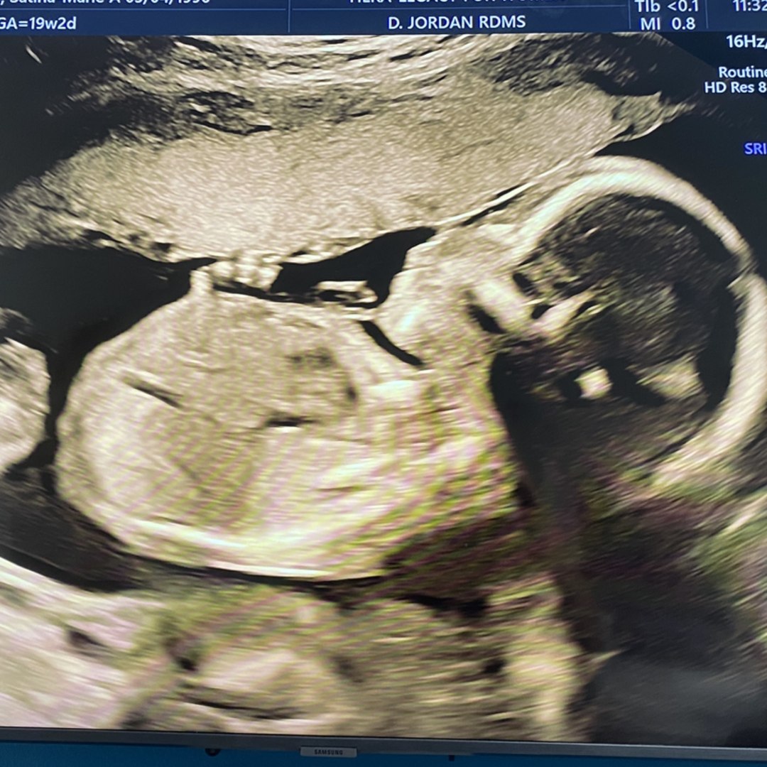 Photo shared by Satina-Marie for their Babylist baby registry.