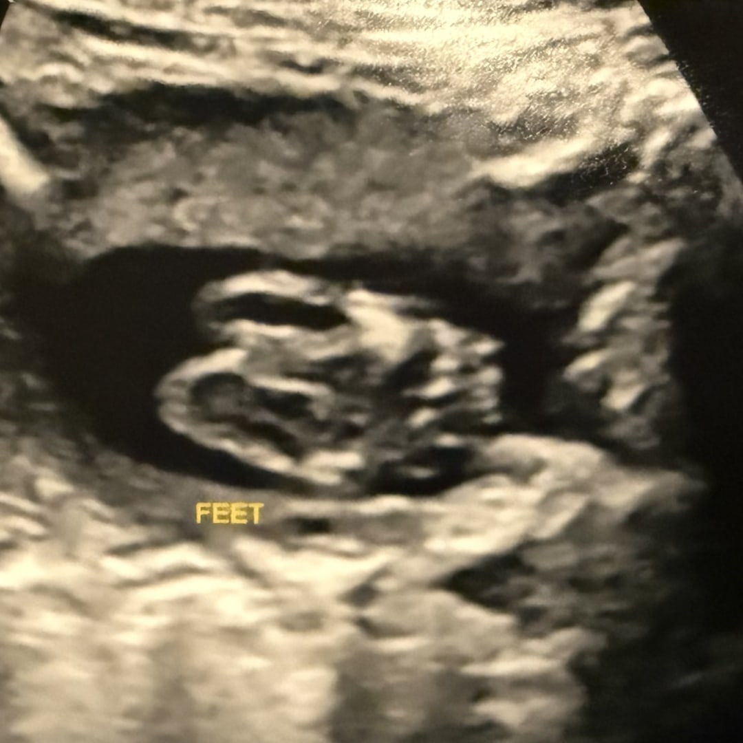 Photo shared by Kalynn for their Babylist baby registry.