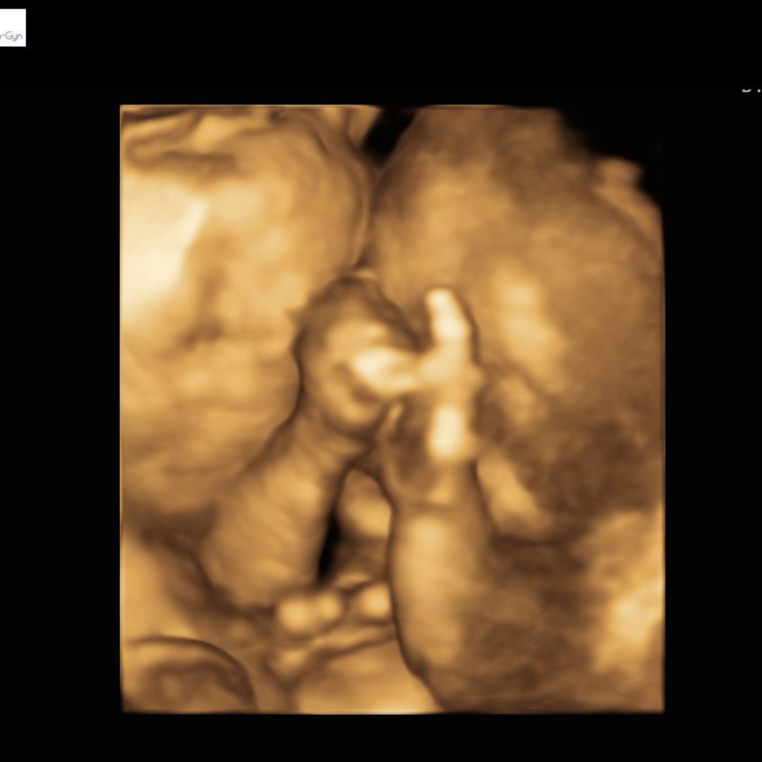 Photo shared by Christina for their Babylist baby registry.