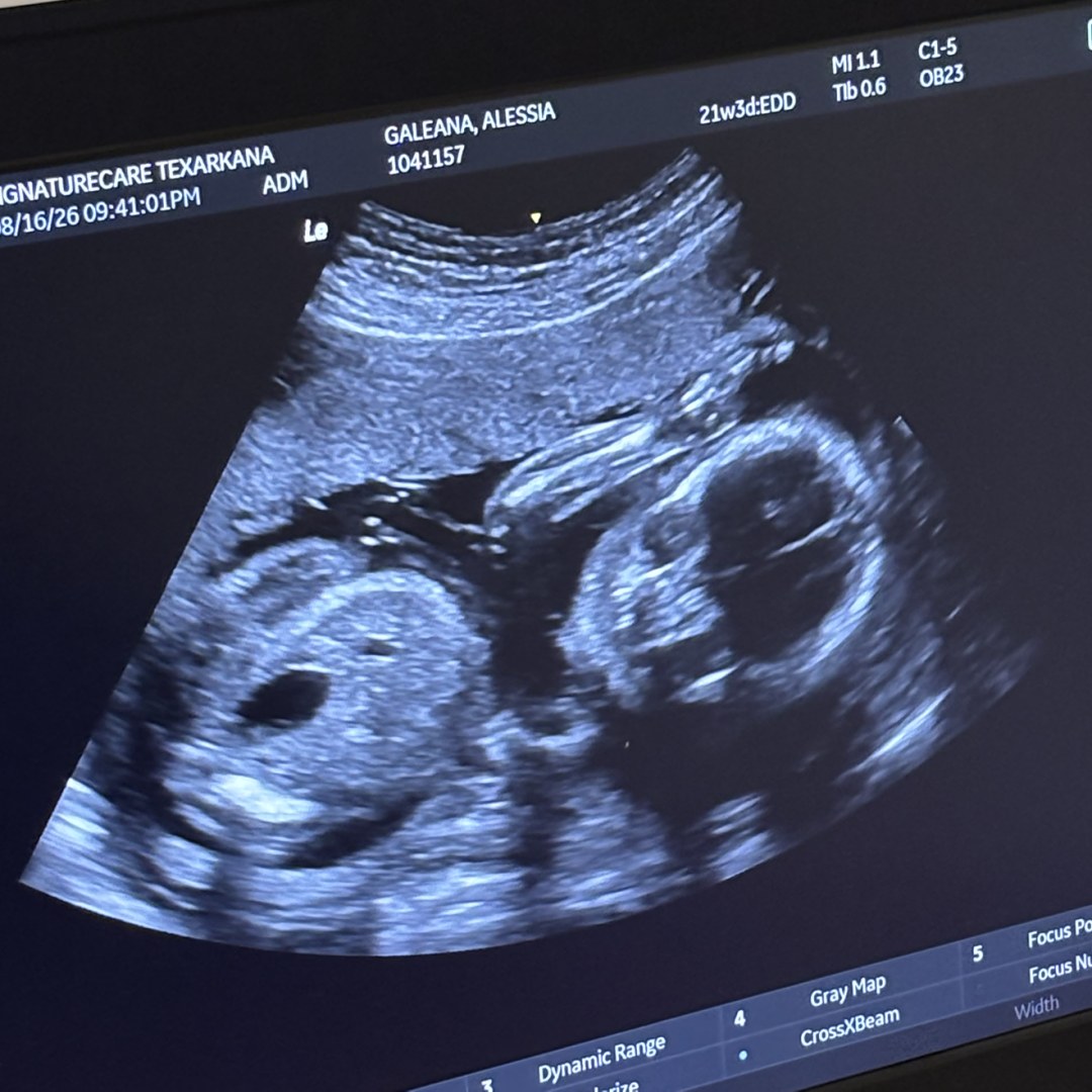 Photo shared by Alessia for their Babylist baby registry.